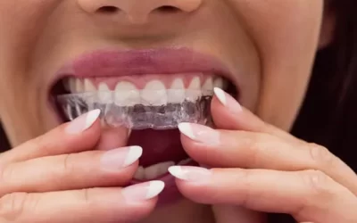 Invisalign Van Nuys: Clear Aligner Therapy for Discreet Orthodontic Correction